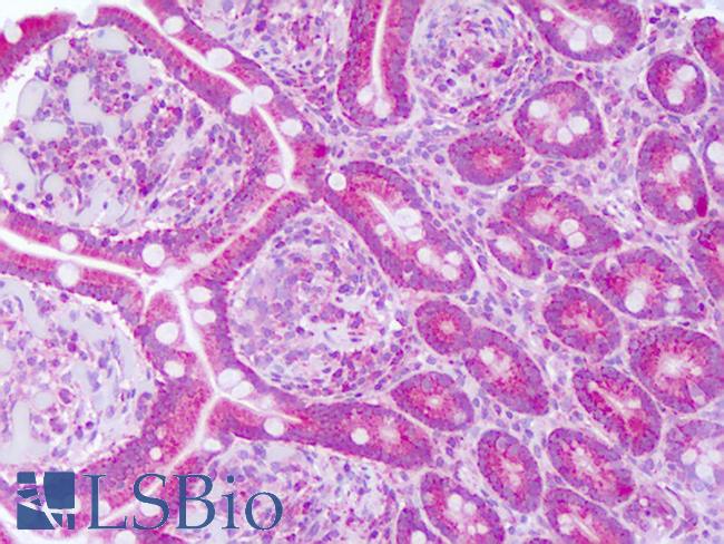 NT5E / eNT / CD73 Antibody - Anti-CD73 antibody IHC of human small intestine. Immunohistochemistry of formalin-fixed, paraffin-embedded tissue after heat-induced antigen retrieval. Antibody dilution 5-10 ug/ml. This image was taken for the unconjugated form of this product. Other forms have not been tested.