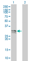 NT5E / eNT / CD73 Antibody - Western Blot analysis of NT5E expression in transfected 293T cell line by NT5E monoclonal antibody (M01), clone 4C4-2B5.Lane 1: NT5E transfected lysate(30.36 KDa).Lane 2: Non-transfected lysate.