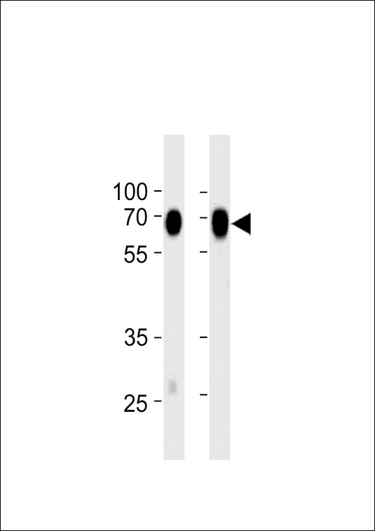 NT5E / eNT / CD73 Antibody - CD73 (NT5E) Antibody western blot of MDA-MB-231,WiDr cell line lysates (35 ug/lane). The CD73 (NT5E) antibody detected the CD73 (NT5E) protein (arrow).