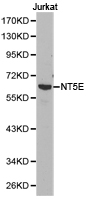 NT5E / eNT / CD73 Antibody - Western blot of extracts of Jurkat cell lines, using NT5E antibody.