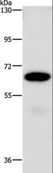 NT5E / eNT / CD73 Antibody - Western blot analysis of A549 cell, using NT5E Polyclonal Antibody at dilution of 1:850.