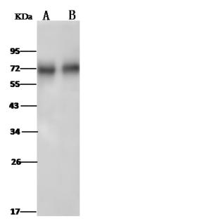 NT5E / eNT / CD73 Antibody - Anti-NT5E rabbit polyclonal antibody at 1:500 dilution. Lane A: Rat spleen tissue lysate. Lane B: Rat liver tissue lysate. Lysates/proteins at 30 ug per laneSecondaryGoat Anti-Rabbit IgG (H+L)/HRP at 1/10000 dilution. Developed using the ECL technique. Performed under reducing conditions. Predicted band size: 63 kDa. Observed band size: 70 kDa.