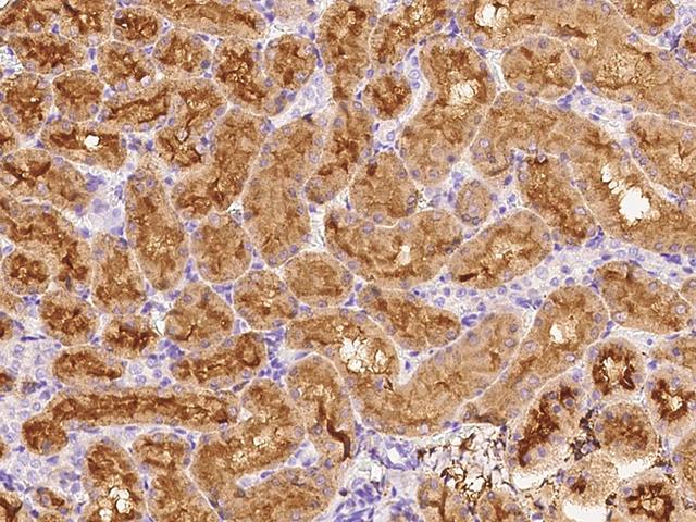 NT5E / eNT / CD73 Antibody - Immunochemical staining of rat NT5E in rat kidney with rabbit polyclonal antibody at 1:5000 dilution, formalin-fixed paraffin embedded sections.