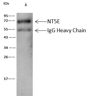 NT5E / eNT / CD73 Antibody - ratNT5E was immunoprecipitated using: Lane A: 0.5 mg A375 Whole Cell Lysate. 0.5 uL anti-ratNT5E rabbit polyclonal antibody and 60 ug of Immunomagnetic beads Protein A/G. Primary antibody: Anti-ratNT5E rabbit polyclonal antibody, at 1:500 dilution. Secondary antibody: Clean-Blot IP Detection Reagent (HRP) at 1:1000 dilution. Developed using the ECL technique. Performed under reducing conditions. Predicted band size: 63 kDa. Observed band size: 72 kDa.