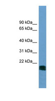 NT5M Antibody - NT5M antibody Western blot of A549 cell lysate. This image was taken for the unconjugated form of this product. Other forms have not been tested.