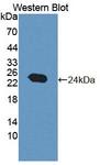 NT5M Antibody - Western Blot; Sample: Recombinant protein.