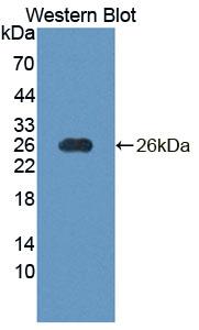 NT5M Antibody - Western Blot; Sample: Recombinant protein.