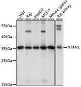 NTAN1 / PNAD Antibody - Western blot analysis of extracts of various cell lines, using NTAN1 antibody at 1:1000 dilution. The secondary antibody used was an HRP Goat Anti-Rabbit IgG (H+L) at 1:10000 dilution. Lysates were loaded 25ug per lane and 3% nonfat dry milk in TBST was used for blocking. An ECL Kit was used for detection and the exposure time was 10s.