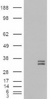 NTF3 / Neurotrophin 3 Antibody - HEK293T cells were transfected with the pCMV6-ENTRY control (Left lane) or pCMV6-ENTRY NTF3 (Right lane) cDNA for 48 hrs and lysed. Equivalent amounts of cell lysates (5 ug per lane) were separated by SDS-PAGE and immunoblotted with anti-NTF3.