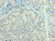 NTF3 / Neurotrophin 3 Antibody - Immunohistochemistry of paraffin-embedded human adrenal gland using antibody at 1:100 dilution.