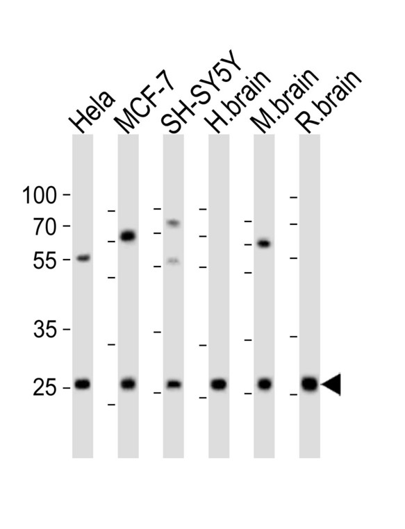 NTF3 / Neurotrophin 3 Antibody - Western blot of lysates from HeLa, MCF-7, SH-SY5Y cell line, human brain, mouse brain, rat brain tissue (from left to right) with NTF3 Antibody. Antibody was diluted at 1:1000 at each lane. A goat anti-rabbit IgG H&L (HRP) at 1:10000 dilution was used as the secondary antibody. Lysates at 20 ug per lane.