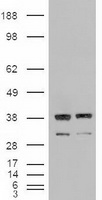 NTF3 / Neurotrophin 3 Antibody - HEK293T cells were transfected with the pCMV6-ENTRY control (Left lane) or pCMV6-ENTRY NTF3 (Right lane) cDNA for 48 hrs and lysed. Equivalent amounts of cell lysates (5 ug per lane) were separated by SDS-PAGE and immunoblotted with anti-NTF3.