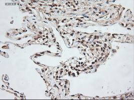 NTF3 / Neurotrophin 3 Antibody - IHC of paraffin-embedded lung using anti-NTF3 mouse monoclonal antibody.