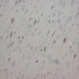 NTF3 / Neurotrophin 3 Antibody -  This image was taken for the unconjugated form of this product. Other forms have not been tested.