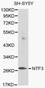 NTF3 / Neurotrophin 3 Antibody - Western blot of NTF3 pAb in extracts from SH-SY5Y cells.