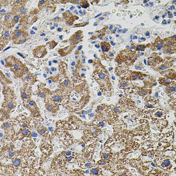 NTF3 / Neurotrophin 3 Antibody - Immunohistochemistry of paraffin-embedded human liver injury using NTF3 antibody (40x lens).
