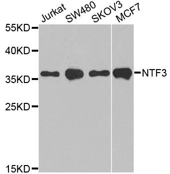 NTF3 / Neurotrophin 3 Antibody - Western blot analysis of extracts of various cell lines, using NTF3 antibody at 1:1000 dilution. The secondary antibody used was an HRP Goat Anti-Rabbit IgG (H+L) at 1:10000 dilution. Lysates were loaded 25ug per lane and 3% nonfat dry milk in TBST was used for blocking. An ECL Kit was used for detection and the exposure time was 90s.