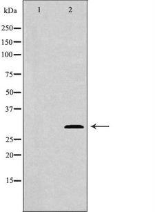 NTF3 / Neurotrophin 3 Antibody - Western blot analysis of SH-SY5Y lysate using NTF3 antibody. The lane on the left is treated with the antigen-specific peptide.