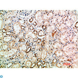 NTF3 / Neurotrophin 3 Antibody - Immunohistochemical analysis of paraffin-embedded human-kidney, antibody was diluted at 1:200.