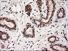 NTF4 / Neurotrophin 4 Antibody - Immunohistochemical staining of paraffin-embedded breast using anti-NTF4 mouse monoclonal antibody.