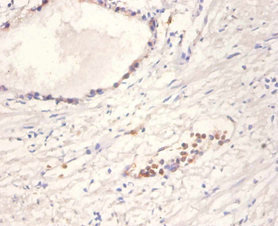 NTF4 / Neurotrophin 4 Antibody - Immunohistochemistry of paraffin-embedded human prostate tissue using NTF4 Antibody at dilution of 1:100