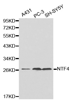NTF4 / Neurotrophin 4 Antibody - Western blot analysis of extracts of various cell lines.