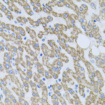 NTF4 / Neurotrophin 4 Antibody - Immunohistochemistry of paraffin-embedded human liver injury using NTF4 antibodyat dilution of 1:100 (40x lens).