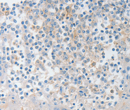 NTF4 / Neurotrophin 4 Antibody - Immunohistochemistry of paraffin-embedded human tonsil tissue using NTF4 antibody.