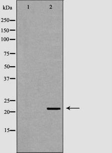 NTF4 / Neurotrophin 4 Antibody - Western blot analysis of HT1080 cell lysates using NTF4 antibody. The lane on the left is treated with the antigen-specific peptide.