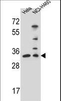 NTHL1 Antibody - NTHL1 Antibody (Center R103) western blot of HeLa,NCI-H460 cell line lysates (35 ug/lane). The NTHL1 antibody detected the NTHL1 protein (arrow).