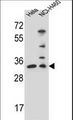 NTHL1 Antibody - NTHL1 Antibody (Center R103) western blot of HeLa,NCI-H460 cell line lysates (35 ug/lane). The NTHL1 antibody detected the NTHL1 protein (arrow).