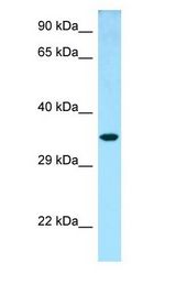 NTHL1 Antibody - NTHL1 antibody Western Blot of Fetal Lung.  This image was taken for the unconjugated form of this product. Other forms have not been tested.