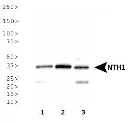 NTHL1 Antibody - NTH1 Antibody - Western blot analysis of NTH1 expression in 1) HeLa, 2) A-431, 3) MCF7 whole cell lysates.  This image was taken for the unconjugated form of this product. Other forms have not been tested.