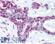 NTHL1 Antibody - Anti-NTH1 antibody IHC of human breast. Immunohistochemistry of formalin-fixed, paraffin-embedded tissue after heat-induced antigen retrieval. Antibody concentration 5 ug/ml.  This image was taken for the unconjugated form of this product. Other forms have not been tested.
