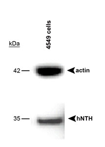 NTHL1 Antibody - Western blot of A549 cells using NTH1 antibody. A band is seen at 35 kD representing NTH1.