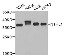 NTHL1 Antibody - Western blot analysis of extracts of various cells.