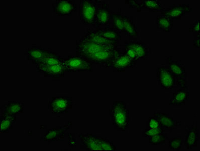 NTHL1 Antibody - Immunofluorescent analysis of Hela cells at a dilution of 1:100 and Alexa Fluor 488-congugated AffiniPure Goat Anti-Rabbit IgG(H+L)