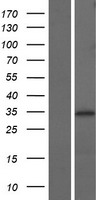 NTHL1 Protein - Western validation with an anti-DDK antibody * L: Control HEK293 lysate R: Over-expression lysate