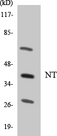 NTM / Neurotrimin Antibody - Western blot analysis of the lysates from HepG2 cells using NT antibody.