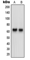 NTM / Neurotrimin Antibody - Western blot analysis of Neurotrimin expression in HeLa (A); HepG2 (B) whole cell lysates.