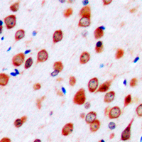 NTM / Neurotrimin Antibody - Immunohistochemical analysis of Neurotrimin staining in human brain formalin fixed paraffin embedded tissue section. The section was pre-treated using heat mediated antigen retrieval with sodium citrate buffer (pH 6.0). The section was then incubated with the antibody at room temperature and detected using an HRP conjugated compact polymer system. DAB was used as the chromogen. The section was then counterstained with hematoxylin and mounted with DPX.
