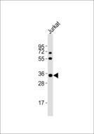 NTM / Neurotrimin Antibody - Anti-Neurotrimin Antibody at 1:1000 dilution + Jurkat whole cell lysates Lysates/proteins at 20 ug per lane. Secondary Goat Anti-Rabbit IgG, (H+L),Peroxidase conjugated at 1/10000 dilution Predicted band size : 38 kDa Blocking/Dilution buffer: 5% NFDM/TBST.