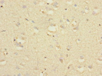 NTM / Neurotrimin Antibody - Immunohistochemistry of paraffin-embedded human brain tissue at dilution 1:100