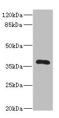 NTM / Neurotrimin Antibody - Western blot All Lanes: CNTN4 antibody IgG at 2.42ug/ml+ Mouse liver tissue Secondary Goat polyclonal to rabbit IgG at 1/10000 dilution Predicted band size: 38,35,40 kDa Observed band size: 38 kDa