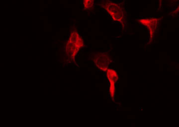 NTM / Neurotrimin Antibody - Staining HuvEc cells by IF/ICC. The samples were fixed with PFA and permeabilized in 0.1% Triton X-100, then blocked in 10% serum for 45 min at 25°C. The primary antibody was diluted at 1:200 and incubated with the sample for 1 hour at 37°C. An Alexa Fluor 594 conjugated goat anti-rabbit IgG (H+L) Ab, diluted at 1/600, was used as the secondary antibody.