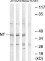 NTM / Neurotrimin Antibody - Western blot analysis of extracts from Jurkat cells, HUVEC cells and HepG2 cells, using NT antibody.