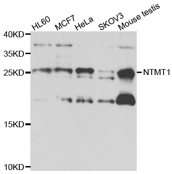 NTMT1 / C9orf32 Antibody - Western blot analysis of extracts of various cell lines.