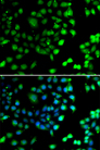 NTMT1 / C9orf32 Antibody - Immunofluorescence analysis of A549 cells.