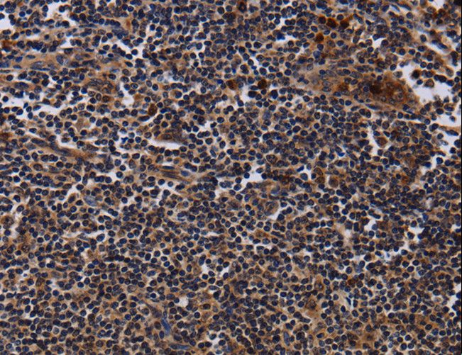 NTMT1 / C9orf32 Antibody - Immunohistochemistry of paraffin-embedded Human tonsil using NTMT1 Polyclonal Antibody at dilution of 1:40.
