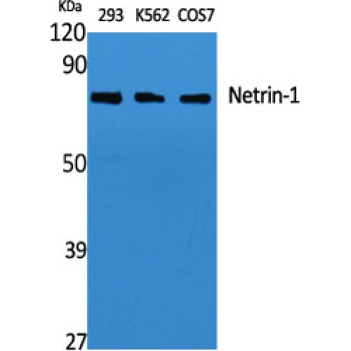 NTN1 / Netrin 1 Antibody - Western blot of Netrin-1 antibody